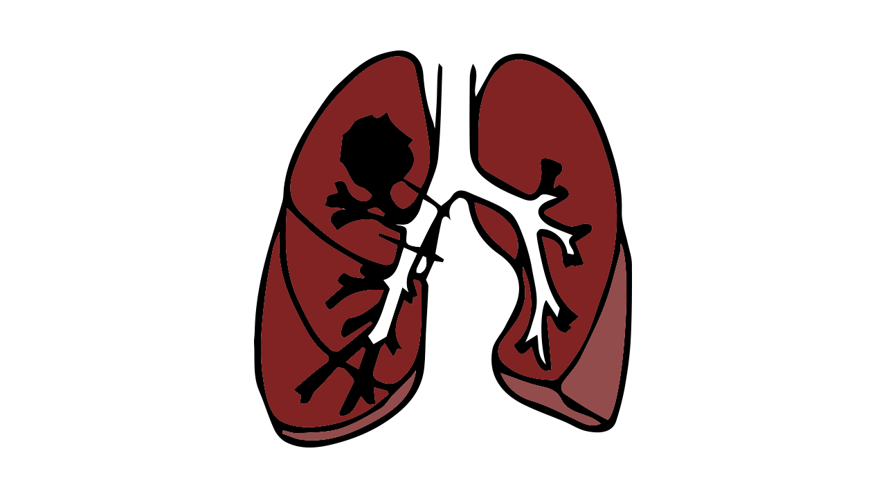 肺的简笔画彩色图片
